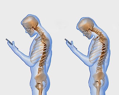 Here's What Texting Really Does to Your Spine Massage Quotes, Text Neck, Tech Neck, Massage For Men, Posture Exercises, Spine Health, Aromatherapy Massage, Getting A Massage, Massage Benefits