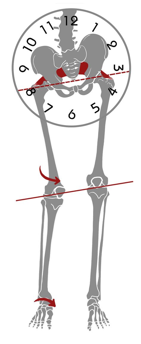 Hip Alignment Exercises, Uneven Hips, Leg Length Discrepancy, Hip Alignment, Piriformis Muscle, Hip Pain Relief, Piriformis Syndrome, Back Stretches For Pain, Pelvic Tilt