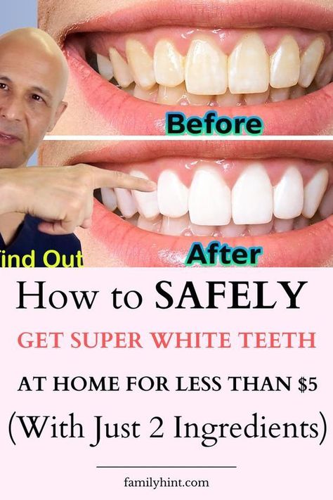 Teeth whitening at home in 3 minutes | How to naturally whiten your yellow teeth | 100% effective Whiten Teeth Naturally, Whiten Your Teeth At Home, Natural Teeth Whitening Diy, Teeth Whiting At Home, Baking Soda Toothpaste, Alcohol Free Mouthwash, Tooth Decay Remedies, Tooth Whitening, Teeth Whitening Diy