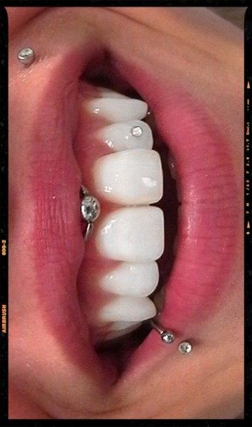 Smiley Piercing / tooth piercing / Monroe Piercing Frowny Piercing Mouth, Inside Mouth Piercings, Mouth Piercings Smiley, Body Piercing Ideas For Women, Smiley Piercing Aesthetic, Piercings Mouth, Piercing Mouth, Nose Piercing Ideas, Lips Ideas