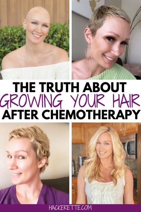 Chemo Short Hair Styles, Growing Hair After Chemo Style, Before Chemo Haircut, Chemo Dinner Ideas, Hairstyles After Chemo Hair Growth, Short Hairstyles After Chemo, Styling Hair After Chemo, Chemo Pixie Haircut, Chemo Grow Out