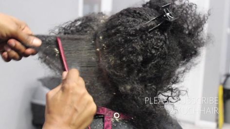 Picking Big Scalp Flakes Psoriasis and Dermatitis Sew In Removal [Video] - https://blackhairinformation.com/video-gallery/picking-big-scalp-flakes-psoriasis-and-dermatitis-sew-in-removal-video/ Dandruff Removal Videos, Scalp Scabs, How To Remove Dandruff, Dandruff Flakes, Flaking Skin, Skin Regimen, Hair Trim, Sew In Weave, Itchy Scalp