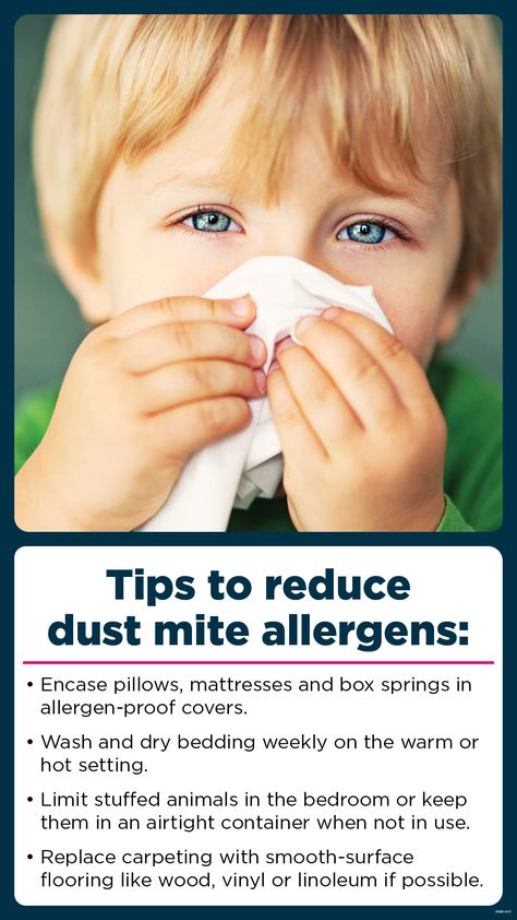 Dust allergies: Putting dust mites to bed Dust Allergies, Chest Tightness, Dust Allergy, Asthma Symptoms, Baking Soda Shampoo, Nasal Congestion, Allergy Symptoms, Shortness Of Breath, Dust Mites