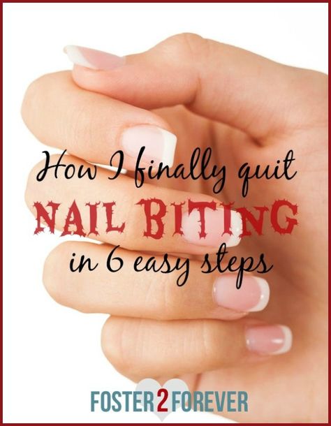 I didn't realize that kicking a lifelong bad habit could really happen! Check out these nail biting remedies! Nail Ideas For Bitten Nails, How To Stop Nail Biting Habit, Stop Biting Nails Remedies, How To Stop Nail Biting, How To Stop Biting Nails, Nail Biting Remedies, Nail Biting Habit, Biting Nails, Nail Remedies