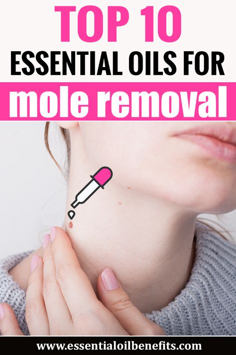 Cancerous Moles, Dark Mole, Red Moles, Skin Moles, Skin Growths, Mole Removal, Home Remedy For Cough, Cold Sores Remedies, Essential Oils For Skin