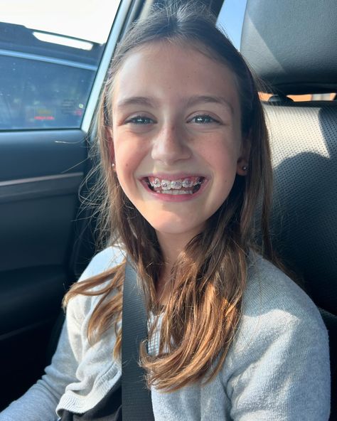 BIG smiles for London today as she got her braces off! 😁😁😁 It’s amazing the change in just 10 months - the last two pictures are the day she got them on last fall! Braces Smile, Braces Off, Big Smiles, London Today, Braces, The Day, London