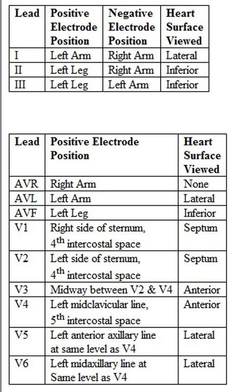 12 Lead Ekg Placement, Ecg Placement, Ekg Placement, Lead Placement, Ekg Technician, Emt Study, Cardiology Nursing, Ekg Interpretation, Medical Assistant Student