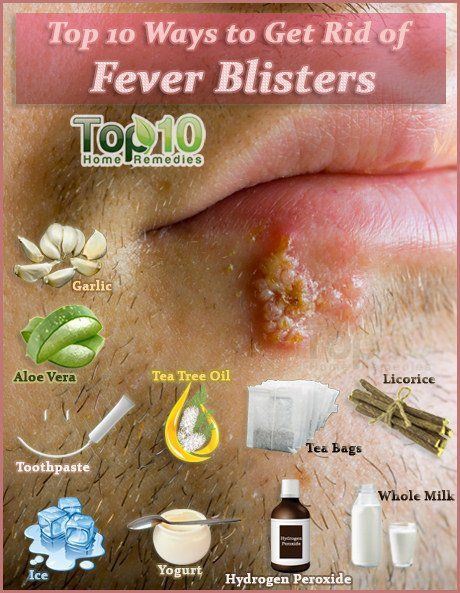 Fever blisters, also known as cold sores, are caused by the herpes simplex type 1 virus. An outbreak usually occurs on or around the mouth and typically heals within two to three weeks. Fever blisters can be a lifelong irritant, since the virus remains dormant in the body throughout your life. Outbreaks can be triggered … Fever Blister Remedy, Blister Remedies, Home Remedies For Fever, Get Rid Of Cold, Fever Blister, Top 10 Home Remedies, Cold Sores, Cold Sores Remedies, Cold Sore