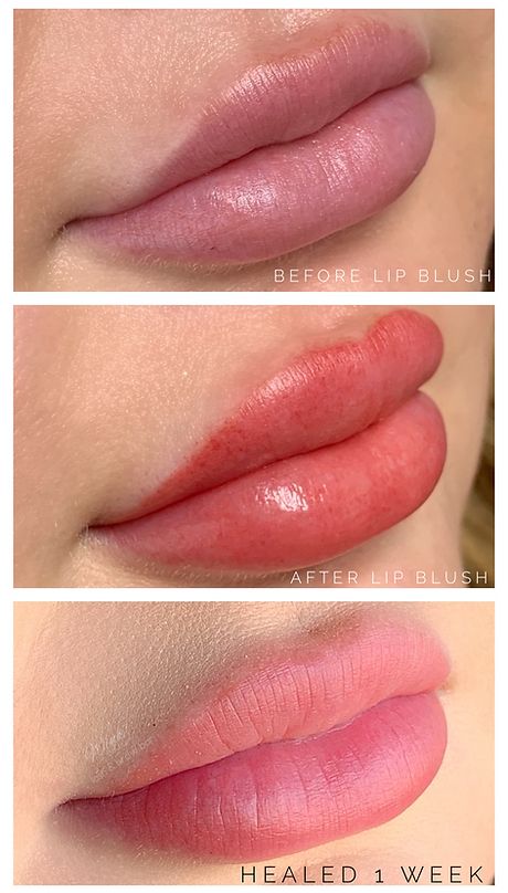 LIP BLUSHING FAQ | wink-iboutique Lip Blushing, Fever Blister, Permanent Cosmetics, Lip Blush, Small Lips, Scar Tissue, Cold Sore, Lip Scrub, Permanent Makeup