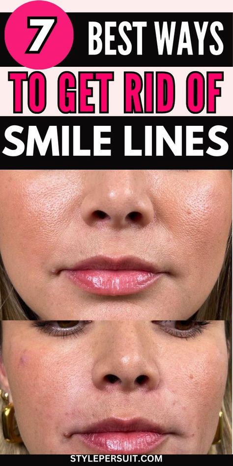 Smile lines, also known as laugh lines or nasolabial folds, are the creases that form around the mouth and nose as a natural part of aging. While they're a testament to a life filled with joy and laughter, some people may feel self-conscious about them and seek ways to minimize their appearance. While completely getting rid of smile lines may not be possible, there are several strategies to reduce their prominence and keep your skin looking youthful and vibrant. Lines Around Mouth, Wrinkles Under Eyes, Natural Wrinkle Reducer, Smile Wrinkles, Natural Wrinkle Remedies, At Home Skincare, Skincare At Home, Skin Care At Home, Skin Care Home Remedies