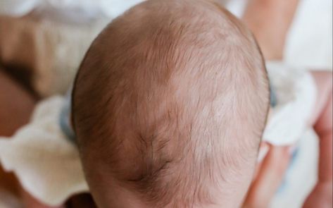 Does your baby have a flat head? Here are some reasons why Flat Head Syndrome happens and when to know your baby needs to see a professional! Kate’s children Flat Head Syndrome, After Baby, Flat Head, Baby Needs, 2 Months, Professions, To Learn, Reading