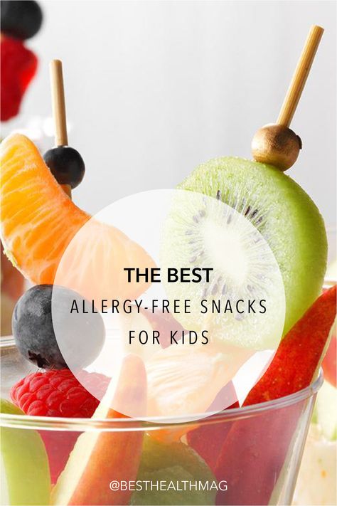 Allergy Friendly Party Food, Dairy Free Birthday Party Food, Non Dairy Snacks, Egg Free Snacks, Allergy Free Snacks, Sunday School Snacks, Mommy Duties, Wheat Allergy, Mom Inspo