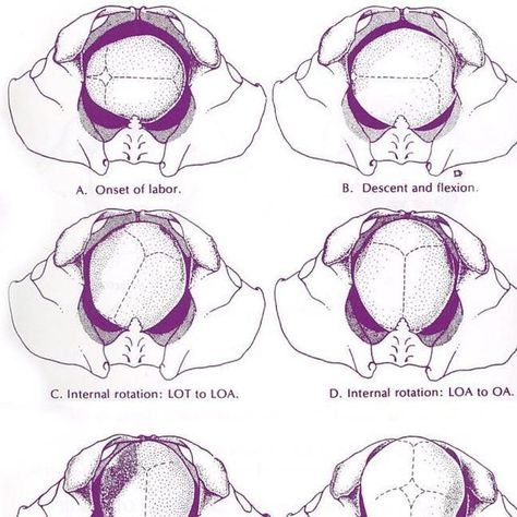 Student Midwife Studygram on Instagram: "👶🏼 This is such a good diagram showing the mechanism of labour 👶🏼 #mechanism #labour #studentmidwife #studygram✨ #studynotesfordays #studentmidwife #studynotesfordays #childbirth #pelvis @cambridgeuniversitypress" Mechanism Of Labour, Midwife Student Aesthetic, Pelvis Anatomy, Birth Support, Midwife Birth, Yoongi Boyfriend, Med Notes, Certified Nurse Midwife, Midwifery Student