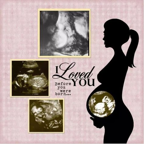 Ultrasound Scrapbook, Pregnancy Scrapbook, Boy Scrapbook Layouts, Custom Scrapbook, Baby Scrapbook Pages, Scrapbooking Layouts Baby, Ultrasound Pictures, Baby Layouts