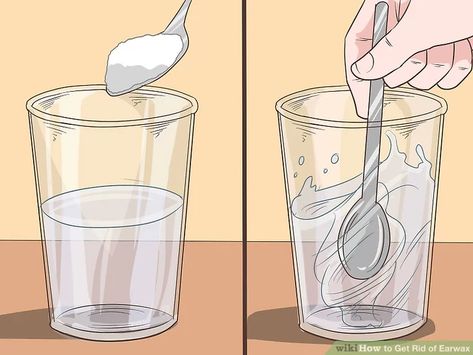 4 Ways to Get Rid of Earwax - wikiHow Diy Ear Wax Removal Remedies, Ear Cleaner For People, Remove Earwax At Home, Clean Ears Wax How To Remove, Earwax Removal Diy, Ear Cleaning Solution For People, How To Clean Your Ears Out, How To Clean Ear Wax Out, Ear Wax Removal Diy