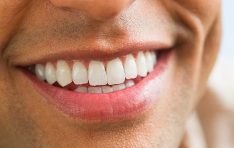 Toothpaste or gel? Strips or pens? 8 Teeth Whitening Products That Actually Work Best Teeth Whitening Products, Teeth Aesthetic, Pretty Teeth, Corrective Makeup, Veneers Teeth, Teeth Whitening Remedies, Beautiful Teeth, Whitening Products, Human Teeth