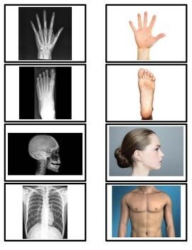 A fun and educational game for kids to learn about the human body. Match the x-rays to the body parts and learn their Human Body Preschool, Preschool Body Theme, Human Body Projects, Preschool Music Activities, Body Preschool, Human Body Activities, Montessori Science, Community Helpers Theme, Human Body Unit