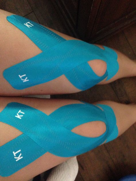 KT tape for Patellar tracking Kinesio Taping Ankle Stability, Kt Tape Knee Patella, How To Put Kt Tape On Your Knee, Knee Kt Taping, Kinesiology Taping Knee, Kinesio Taping Knee, Kt Tape Knee, Knee Taping, K Tape