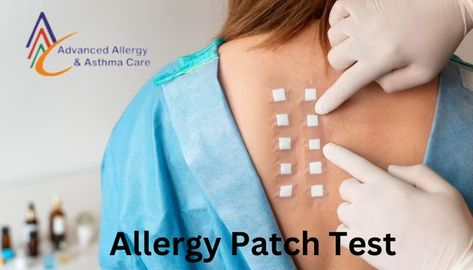 Allergy Patch Test Skin Allergy, Long Books, Skin Patches, Allergy Asthma, Skin Redness, Allergy Testing, Skin Allergies, Allergic Reaction, Sciatica