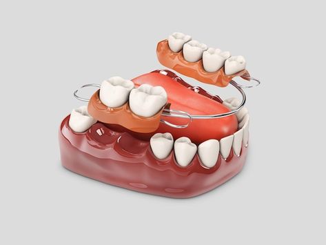 Dental Implant Procedure, Best Dental Implants, Dental Implants Cost, Human Teeth, Missing Teeth, Smile Makeover, Natural Teeth, Dentures, Your Smile