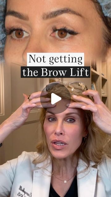 Brow Lift Botox Before And After, Eyebrow Botox Lift, Botox Smile Lift, Botox For Eyebrow Lift, Eye Brow Lift, Botox Brow Lift Injection Site, Eyebrow Lift Before And After, Botox Eyebrow Lift, Brow Lift Botox Eyebrows