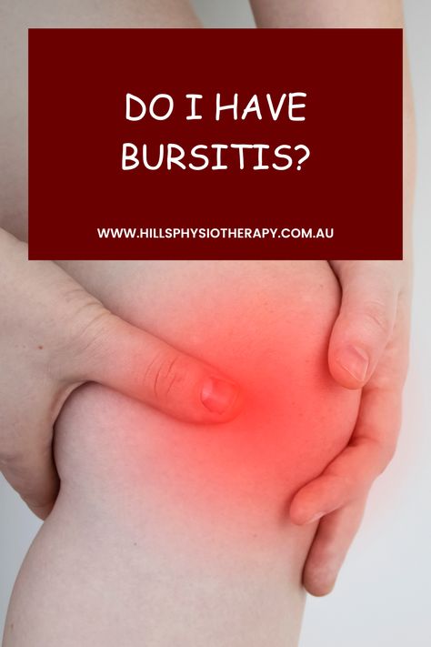 Bursitis Knee Remedies, Bursitis Hip Relief, Knee Bursitis, Voltaren Gel, Bursitis Knee, Gentle Stretches, Targeted Exercises, Knee Strengthening, Bursitis Hip