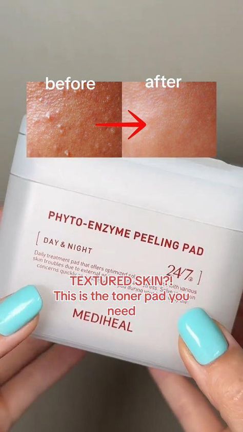 Amazon.com: MEDIHEAL Phyto Enzyme Peeling Pad - Vegan Face Resurfacing Gauze Pads with LHA & Papaya Enzym - Pore Tightening Pads to Control Sebum - Exfoliating Pads for Dead Skin Cells, 90 Pads : Beauty & Personal Care Toner Pads, Texture Skin, Korean Beauty Tips, Textured Skin, Pore Tightening, Exfoliating Pads, Good Skin Tips, Combo Skin, Healthy Skin Tips