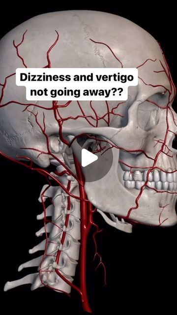 How To Stop Dizziness, Vertigo Causes, Vertigo Exercises, Dizziness Causes, Cervical Spondylosis, Cervical Spine, A Doctor, Blood Flow, The Brain