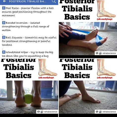 Posterior tibialis rehab Tibialis Posterior Exercise, Tibialis Raise, External Tibial Torsion, Posterior Tibialis, Posterior Tibial Tendon Dysfunction, Tibialis Posterior, Tibialis Anterior, Foot Drop Exercises, Fitness Pilates