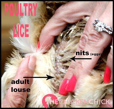 Poultry lice and nits on feathers and skin of a hen. Chicken Mites, Chicken Roost, Scary Story, Chicken Pen, Chicken Feeders, Backyard Chicken Farming, Best Chicken Coop, Raising Backyard Chickens, Chicken Cages