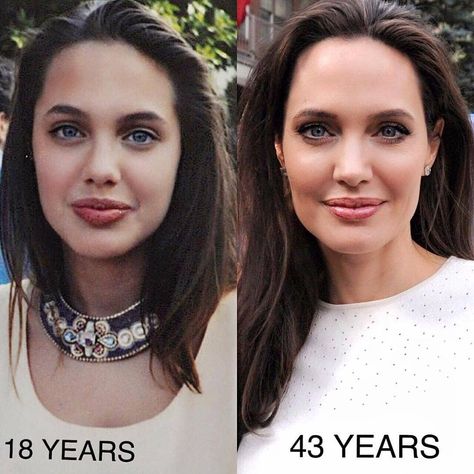 ngelina Jolie at age 18 vs. 43 📷 Follow @80syayo for more � Angelina Jolie Photos, Jolie Pitt, Celebrities Then And Now, Celebrity Plastic Surgery, Actrices Hollywood, After Photos, Grunge Hair, Cosmetic Surgery, Angelina Jolie