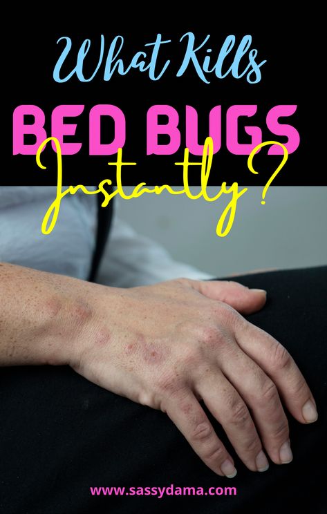 Bed bug bites can be very itchy, annoying, and embarrassing! Here are ways you can identify, prevent, and control bed bugs in your home. What Kills Bed Bugs, Bed Bug Remedies, Household Bugs, Bed Bug Trap, Get Rid Of Bed Bugs, Bed Bug Spray, Bug Spray Recipe, Kill Bed Bugs, Rid Of Bed Bugs