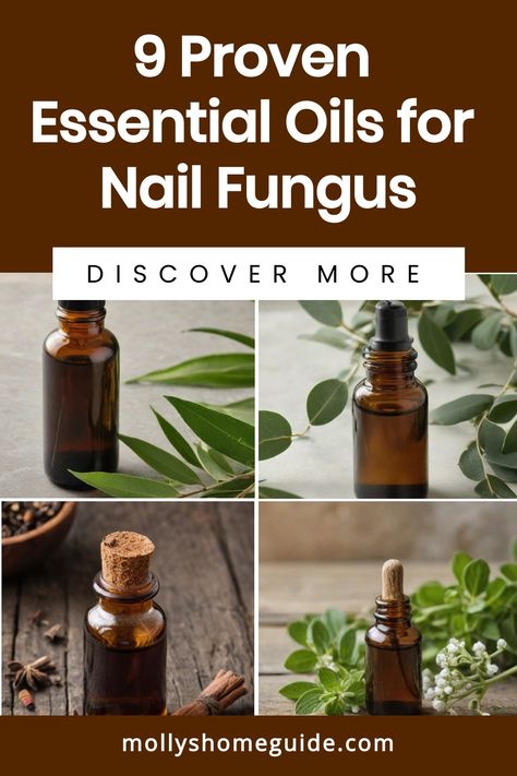 Fungi Recipe, Natural Antifungal, Fingernail Fungus, Toenail Fungus Remedies, Nail Fungus Remedy, Fungal Nail, Cinnamon Essential Oil, Nail Care Routine, Nail Oil