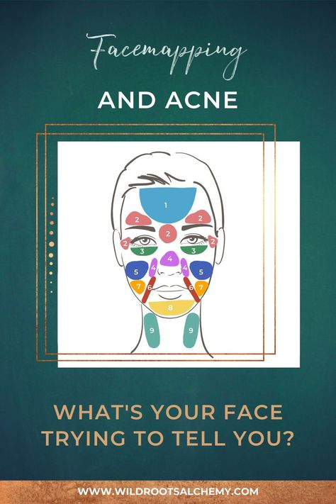 Have you ever wondered why you usually get break-outs only on specific parts of your face? Facemapping is a tool that allows you to read your skin's patterns and follow the "clues" to see what organ systems (lymphatic, liver/gallbladder, gastrointestinal, hormonal, etc.) are out of balance and need support. Cinnamon Face Mask, Face Breaking Out, Healing Acne, Face Pores, Acne Overnight, Acne Face Mask, Diy Acne, Natural Acne Remedies, Face Acne