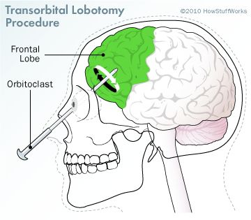 HowStuffWorks "What will medicine consider unethical in 100 years?" Harrison Bergeron, Frontal Lobe, Vintage Medical, Essay Topics, Medical Illustration, Human Brain, Neurology, Psychiatry, Neuroscience