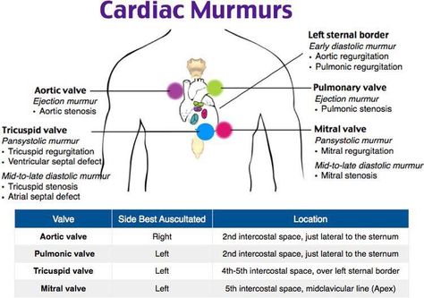 Cardiac Murmurs, Nursing Cardiac, Nurse Practioner, Cardiology Nursing, Np School, Pediatric Nurse Practitioner, Nurse Practitioner School, Nursing 101, Brain Book