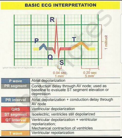 Dysrhythmia interpretation Ekg Interpretation, Ecg Interpretation, Nursing Cheat, Nursing Mnemonics, Nursing Schools, Cardiac Nursing, Critical Care Nursing, Respiratory Therapy, Nursing School Studying