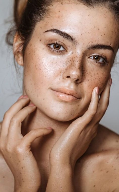 Woman With Freckles, Women With Freckles, Beautiful Freckles, Freckles Girl, Forehead Wrinkles, Clear Skin Tips, Brunette Woman, Celebrity Makeup Artist, No Makeup