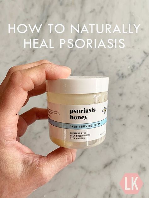 Hs Skin Disease Natural Remedies, Psoriatic Skin Essential Oils, Psoriatic Skin Natural Remedies, Psoriatic Skin Remedies, Psoriatic Skin Diet, Psoriatic Skin Remedies Diy, Psoriatic Skin, Scalp Psiorasis, Scalp Psorasischic