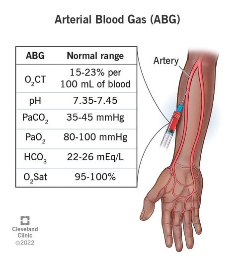 Med School Notes, Arterial Blood Gas, Septic Shock, Blood Test Results, Normal Values, Lung Conditions, Lung Health, Pulmonology, Organ System