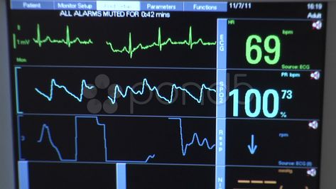 Medical EKG Heart Rate Monitor at Hospital - Close Up Stock Footage #AD ,#Heart#Rate#Medical#EKG Heartbeat Monitor Aesthetic, Heart Beat Machine In Hospital, Heart Monitor Aesthetic, Ekg Aesthetic, Hospital Heart Monitor, Heartbeat Aesthetic, Jennifer Hartmann, Heartbeat Monitor, Heartbeat Line