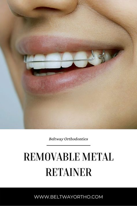 Beltway Orthodontics

Address: 857 Collier Rd NW Suite 5A-5B, Atlanta, GA 30318, United States

Phone: (404) 689-4140 Metal Retainers For Teeth, Retainers For Teeth, Teeth After Braces, Hawley Retainer, Retainer Teeth, After Braces, Dream Physique, Orthodontics Braces, Metal Wire