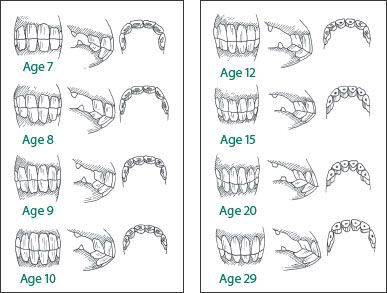 Horse Age Chart, Horse Teeth Age Chart, How To Tell Horses Age, Horse Bone Anatomy, Horse Diagram Anatomy, Horse Age, Equine Care, Healthy Horses, Horse Lessons