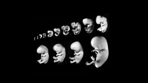 * Embryo Development, Prenatal Development, Human Embryo, Fetal Development, Be Confident, Scientists, Human, 10 Things