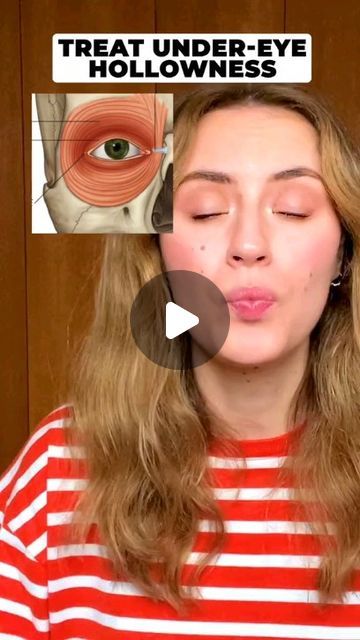 Under Eye Hollows Exercise, Hollow Eyes Remedy, Hollow Under Eyes, Under Eye Care, Eye Yoga, Under Eye Hollows, Facial Fitness, Hollow Eyes, Sunken Eyes