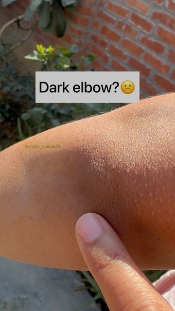 fashion_culture70 on Instagram: "Dark elbow?☹️ Try this remedy❤️ Follow @fashion_culture70 for more videos #reels #darknessremoval #darkneck #suntan #suntanremoval #skincaretips #glowup #haircare #viral #viralvideos #explore #instagram" Natural Skin Care Ingredients, Natural Skin Care Remedies, Natural Face Skin Care, Diy Skin Care Routine, Tips Skincare, Good Skin Tips, Basic Skin Care Routine, Perfect Skin Care Routine, Homemade Beauty