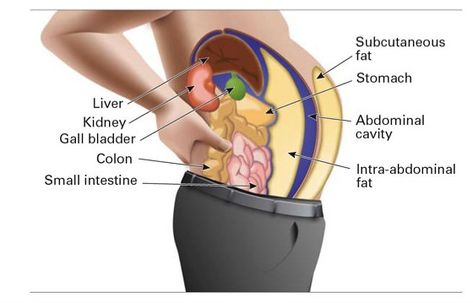 Kidney Detox, Body Flush, Visceral Fat, Health Ideas, Body Organs, What Is The Difference Between, Insulin Resistance, Lose Belly, Body Fat