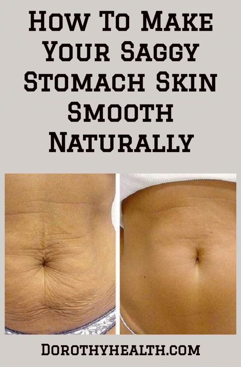 Loose Skin Tightening, Big Aesthetic, Tighten Stomach, Sagging Cheeks, Sagging Face, Anti Aging Neck, Loose Belly, Home Remedies For Skin, Tighten Loose Skin