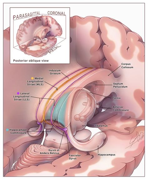 Mri Scans Aesthetic, Aesthetic Brain Art, Corpus Callosum, Bacillus Subtilis, Studying Medicine, Medical School Life, Medicine Notes, Basic Anatomy And Physiology, Medical Videos