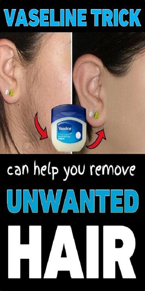 This Vaseline Trick Can Help You Remove Unwanted Hair Best Permanent Hair Removal, Permanent Hair Removal Cream, Permanent Facial Hair Removal, Back Hair Removal, Best Facial Hair Removal, Electrolysis Hair Removal, Lip Hair Removal, Upper Lip Hair, Ingrown Hair Removal